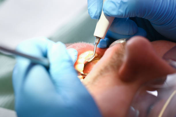 Best Same-Day Emergency Dentist in Rouse, CA