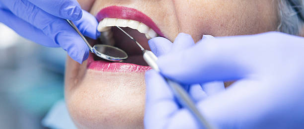 Best Emergency Treatment for Toothache in Rouse, CA